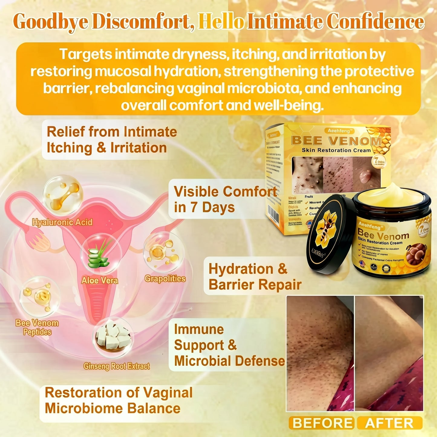 🔥 LAST DAY 80% OFF🔥 Aeehfeng® Bee Venom Skin Restoration Cream